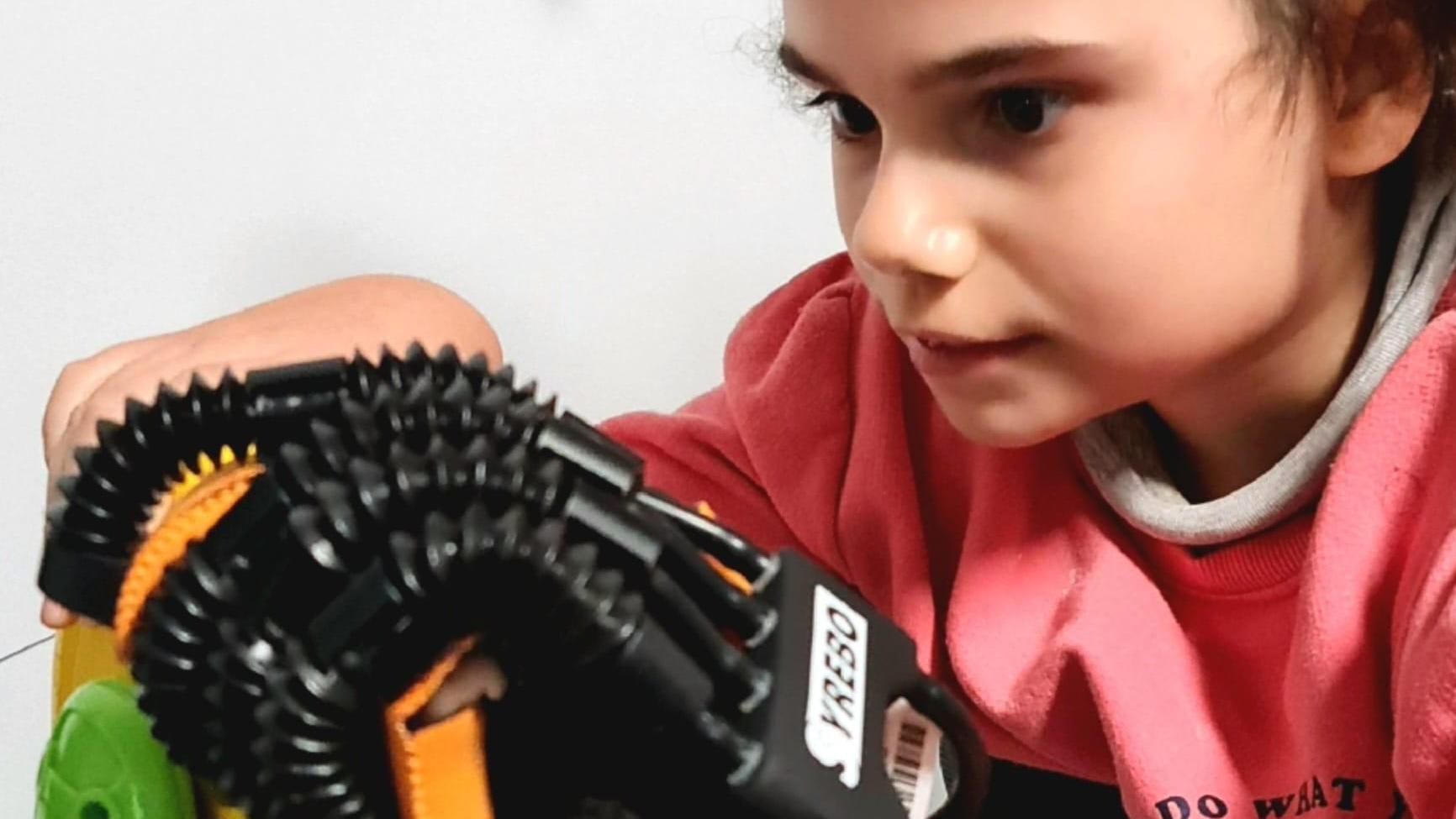 Proyecto de rehabilitación con guante robótico para niñas con síndrome de Rett